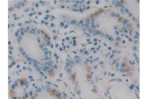 Detection of EBI3 in Human Stomach Tissue using Monoclonal Antibody to Epstein Barr Virus Induced Protein 3 (EBI3) (EBI3 antibody  (AA 21-229))