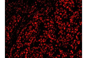 anti-A Kinase (PRKA) Anchor Protein 8-Like (AKAP8L) (AA 596-646) antibody