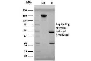 Progesterone antibody