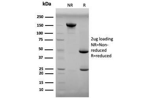 Progesterone antibody