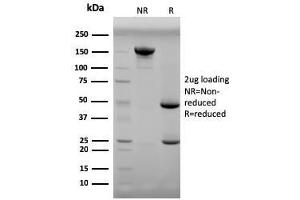 SDS-PAGE Analysis Purified Progesterone Mouse Monoclonal Antibody (6-5E-3F). (Progesterone antibody)
