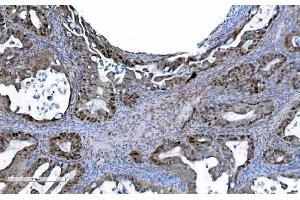 IHC analysis of MCM6 using anti-MCM6 antibody (ABIN7600036).