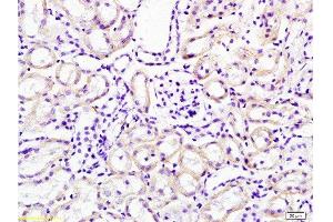 Formalin-fixed and paraffin embedded mouse kidney tissue labeled with Anti-Cathepsin H Polyclonal Antibody, Unconjugated  at 1:200 followed by conjugation to the secondary antibody, (SP-0023), and DAB staining (Cathepsin H antibody  (AA 71-170))