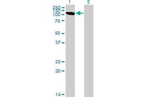 Western Blot analysis of CLCN2 expression in transfected 293T cell line by CLCN2 monoclonal antibody (M01), clone 3E1. (CLCN2 antibody  (AA 38-387))