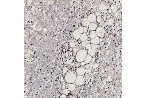 IHC analysis of SF3B3 using anti-SF3B3 antibody (ABIN7602378).
