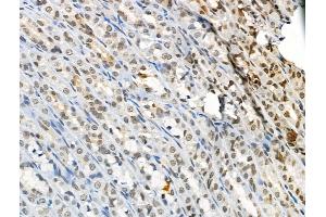 ABIN6256762 and ABIN6267084 at 1/100 staining Rat stomach tissue by IHC-P. (BTK antibody  (pTyr551))