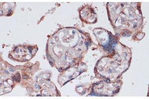 Immunohistochemistry of paraffin-embedded Human placenta using RPS13 Polyclonal Antibody at dilution of 1:100 (40x lens). (RPS13 antibody)