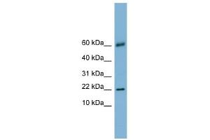 LGALS14 antibody used at 1 ug/ml to detect target protein. (LGALS14 antibody  (N-Term))