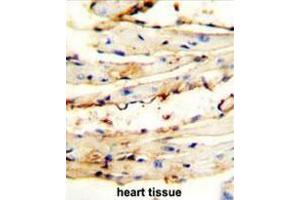 CRCT1 antibody (N-term) immunohistochemistry analysis in formalin fixed and paraffin embedded mouse heart tissue followed by peroxidase conjugation of the secondary antibody and DAB staining. (CRCT1 antibody  (N-Term))