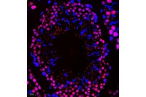 Immunofluorescence of paraffin embedded mouse testis using Api5 (ABIN7073094) at dilution of 1:400 (400x lens) (Apoptosis Inhibitor 5 antibody)