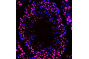 Immunofluorescence of paraffin embedded mouse testis using Api5 (ABIN7073094) at dilution of 1:400 (400x lens) (Apoptosis Inhibitor 5 antibody)