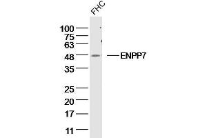 FHC Cell lysates probed with ENPP7 Polyclonal Antibody, unconjugated  at 1:300 overnight at 4°C followed by a conjugated secondary antibody for 60 minutes at 37°C. (ENPP7 antibody  (AA 351-458))