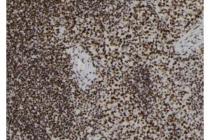 ABIN6277977 at 1/100 staining Mouse spleen tissue by IHC-P. (FYB antibody)