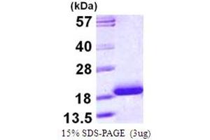 SDS-PAGE (SDS) image for Cardiac Troponin C (TNNC1) (AA 1-161) protein (His tag) (ABIN667967) (TNNC1 Protein (AA 1-161) (His tag))