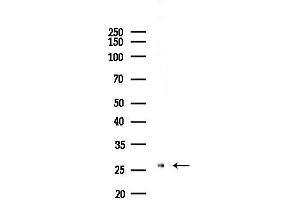 anti-ELOVL Fatty Acid Elongase 5 (ELOVL5) (C-Term) antibody