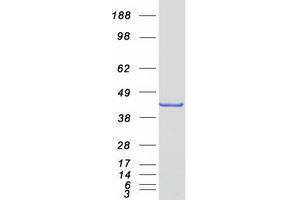 Enoyl-CoA Delta Isomerase 2 (PECI) (Transcript Variant 1) protein (Myc-DYKDDDDK Tag)