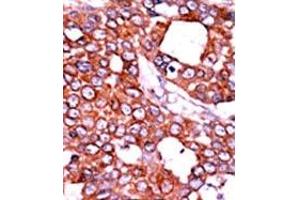 Image no. 2 for anti-Cell Division Cycle 25 Homolog A (S. Pombe) (CDC25A) (pThr507) antibody (ABIN358098) (CDC25A antibody  (pThr507))