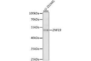 Western blot analysis of extracts of U-251MG cells, using ZNF19 antibody (ABIN6291091) at 1:1000 dilution.