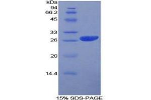 SDS-PAGE analysis of Human Prion Protein. (PRNP Protein)