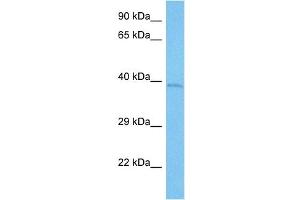 Host:  Mouse  Target Name:  KCNAB2  Sample Tissue:  Mouse Small Intestine  Antibody Dilution:  1ug/ml (KCNAB2 antibody  (C-Term))