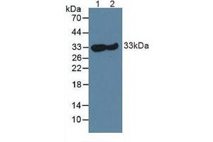 Western blot analysis of (1) Mouse Skeletal Muscle Tissue and (2) Rat Skeletal Muscle Tissue. (CA3 antibody  (AA 2-260))
