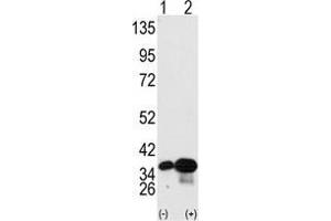 Western blot analysis of PHB2 (arrow) using PHB2 Antibody . (Prohibitin 2 antibody  (Tyr248))