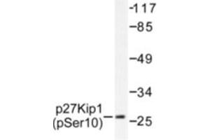 Image no. 1 for anti-Cyclin-Dependent Kinase Inhibitor 1B (p27, Kip1) (CDKN1B) (pSer10) antibody (ABIN318090)