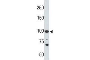 Western blot testing of Angiotensin-converting enzyme 2 antibody and 293 cell lysate. (ACE2 antibody  (AA 773-805))