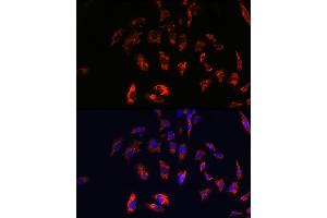 Immunofluorescence (IF) image for anti-HLA-DR-gamma (CD74) (AA 73-232) antibody (ABIN6138228)