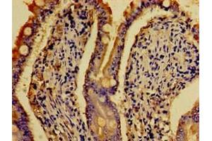 Immunohistochemistry of paraffin-embedded human small intestine tissue using ABIN7142640 at dilution of 1:100 (Serotonin Receptor 4 antibody  (AA 316-388))