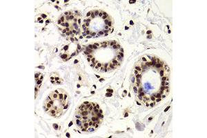 Immunohistochemistry (Paraffin-embedded Sections) (IHC (p)) image for anti-X-Ray Repair Complementing Defective Repair in Chinese Hamster Cells 6 (XRCC6) (AA 500-600) antibody (ABIN1513143)