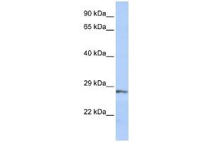 SFRP2 antibody used at 1 ug/ml to detect target protein. (SFRP2 antibody  (Middle Region))