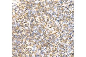 Immunohistochemistry (Paraffin-embedded Sections) (IHC (p)) image for anti-Linker For Activation of T Cells (LAT) antibody (ABIN7074502)