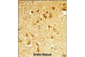 Formalin-fixed and paraffin-embedded human brain tissue reacted with DDX17 Antibody (N-term), which was peroxidase-conjugated to the secondary antibody, followed by DAB staining. (DDX17 antibody  (N-Term))