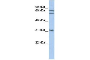 WB Suggested Anti-GPHN Antibody Titration: 0. (Gephyrin antibody  (Middle Region))