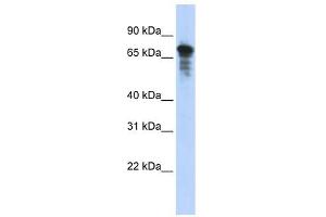 RHPN1 antibody used at 1 ug/ml to detect target protein. (RHPN1 antibody  (Middle Region))