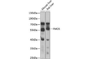 Western blot analysis of extracts of various cell lines, using FMO5 antibody (ABIN6133516, ABIN6140714, ABIN6140715 and ABIN6223596) at 1:1000 dilution. (FMO5 antibody  (AA 1-285))