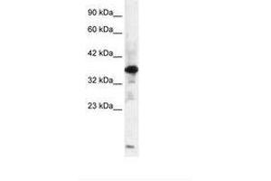 Image no. 2 for anti-Zinc Finger Protein-Like 1 (ZFPL1) (AA 101-150) antibody (ABIN6735842) (ZFPL1 antibody  (AA 101-150))