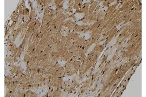 ABIN6273130 at 1/100 staining Mouse heart tissue by IHC-P.