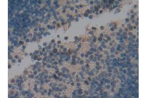 IHC-P analysis of Mouse Spleen Tissue, with DAB staining.