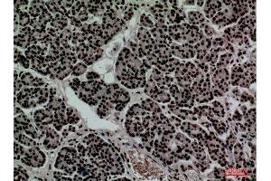 Immunohistochemistry (IHC) image for anti-CD2 (CD2) (N-Term) antibody (ABIN3187772)