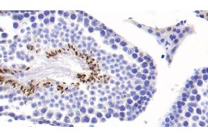 Detection of COMP in Mouse Testis Tissue using Monoclonal Antibody to Cartilage Oligomeric Matrix Protein (COMP) (COMP antibody  (AA 554-753))
