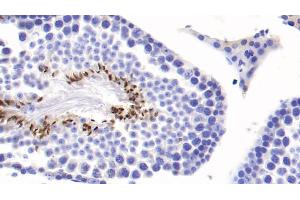 Detection of COMP in Mouse Testis Tissue using Monoclonal Antibody to Cartilage Oligomeric Matrix Protein (COMP)