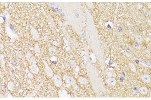 Immunohistochemistry of paraffin-embedded Mouse brain using SEPT5 Polyclonal Antibody at dilution of 1:100 (40x lens). (Septin 5 antibody)