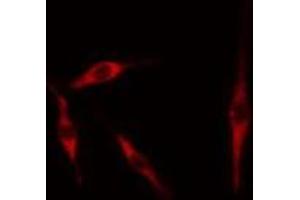 ABIN6276729 staining 293 cells by IF/ICC. (Tryptophan Hydroxylase 1 antibody  (Internal Region))