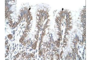 Image no. 1 for anti-arginine/serine-Rich Coiled-Coil 2 (RSRC2) (AA 363-412) antibody (ABIN321837) (RSRC2 antibody  (AA 363-412))
