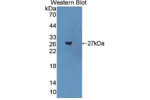 Figure. (Basonuclin 1 antibody  (AA 43-246))