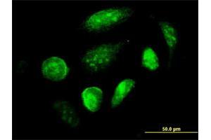 Immunofluorescence of monoclonal antibody to GCM1 on HeLa cell. (GCM1 antibody  (AA 108-166))