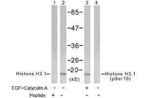 Image no. 2 for anti-Histone H3.1 (HIST1H3B) (pSer10) antibody (ABIN196922)