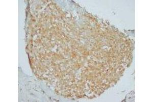 Image no. 1 for anti-Golgin, RAB6-Interacting (GORAB) (Internal Region) antibody (ABIN1490361) (GORAB antibody  (Internal Region))